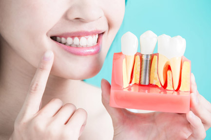 Dental Implant Clinic in Balewadi